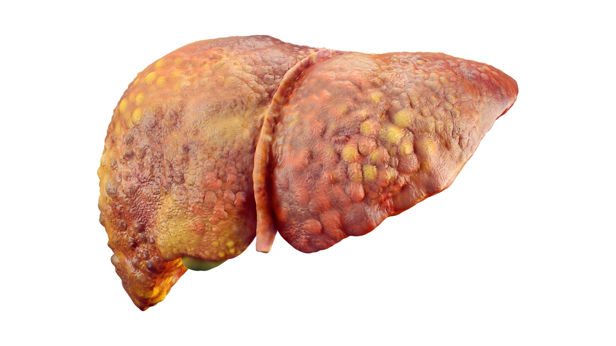 7 Signes Montrent Que Votre Foie Est Malade