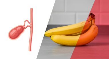 Banane Et Calcul Biliaire
