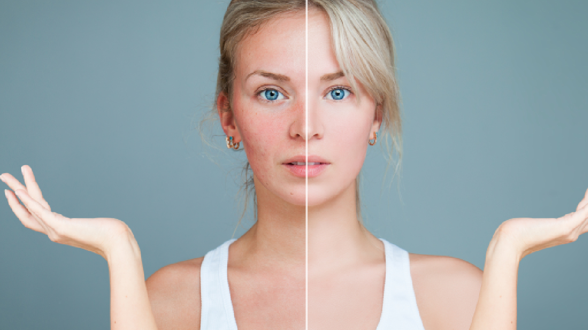 Creme Solaire Changement Couleur